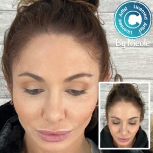Image of female SMP result after scalp micro pigmentation on hairline